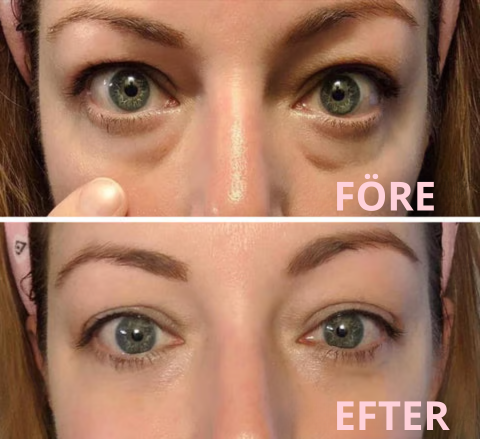 Eyeveil- Fokus på dig! inte på dina mörka ringar